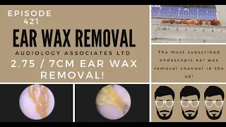 2.75IN/7CM EAR WAX REMOVAL - EP 421