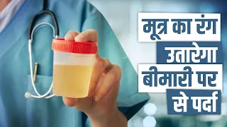 Your Urine Color Says About Your Health | Urine Analysis | Urine Explained in Hindi | Shuddhi Clinic