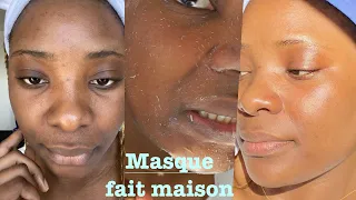 Comment faire : un masque fait maison, peau abimée, stress, hyperpygmentation, extraction sebum