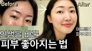 Eng cc) How I changed my skin healthy | Skin care routine✨