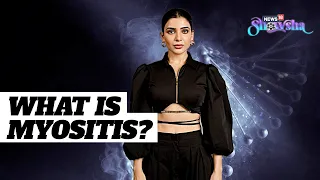 Samantha Ruth Prabhu Diagnosed With Myositis | What Is This Auto-Immune Condition? | Explained