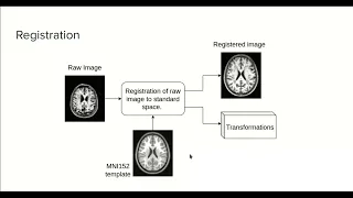 6.0 - MRI image registration with ANTsPy - Course MRI preprocessing with Python