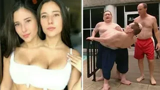 Most Unique Unusual Siamese Twins You Won't Believe Exist.