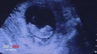 DEMON SPOTTED NEXT TO BABY IN ULTRASOUND SCAN? JANUARY 9, 2016 (EXPLAINED)