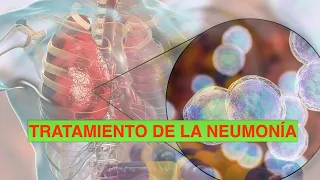 Tratamiento empirico de la Neumonia. ¿Qué antibiótico usar?