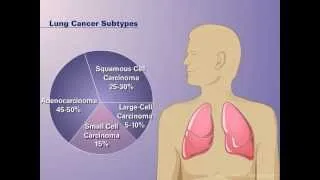 The Pathophysiology of Non-small Cell Lung Cancer