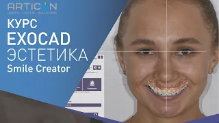 Презентация EXOCAD SMILE CREATOR (DENTAL-EXPO 2019)