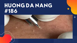 #186 | Huong Da Nang