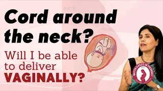 My baby has a cord around the neck! Will I be able to deliver vaginally? Dr. Anjali Kumar | Maitri