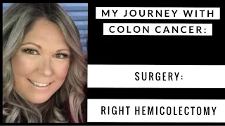 My Journey With Colon Cancer - Episode #3 - Colon Resection Surgery