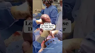 Don’t ❌ Let Your Nurse Do THIS After C-Section! #csection