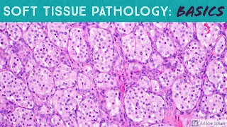 Basic Soft Tissue Pathology Cases: Explained by a Sarcoma Pathologist