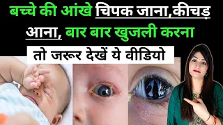 क्या आपके बच्चे की आँखों से पानी आ रहा है? || अवरुद्ध आंसू वाहिनी / Blocked Tear Duct