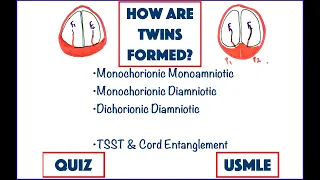 Twins: Chorionic & Amniotic | Identical vs Fraternal | TTTS | USMLE | MCQ