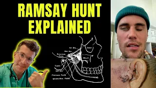 Doctor explains Ramsay Hunt syndrome (as seen with Justin Bieber) causing facial nerve paralysis...