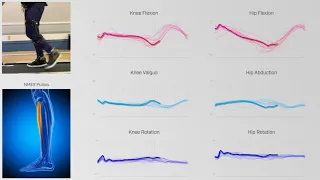 Real time adaptive augmentation of movement