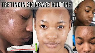 HOW TO: GET RID OF ACNE & ACNE SCARS | TRETINOIN SKINCARE ROUTINE ♡ @OfficialTashika