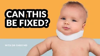 Torticollis Treatment for a baby