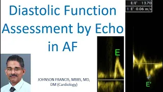 Diastolic function assessment by echo in AF
