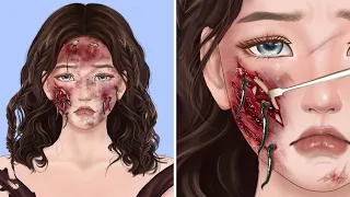 ASMR Remove Worm Infected | Severely Injured Animation