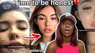 Madison Beer  FINALLY breaks her SILENCE and ADRESSES the CONTROVERSY surrounding her LOOKS