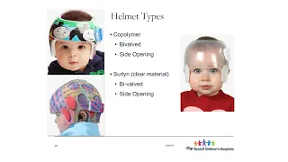 Cranial Remolding Helmets