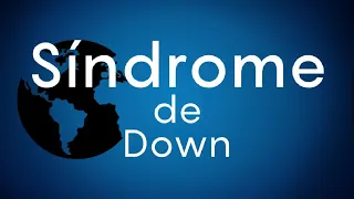 ¿Qué es el Síndrome de Down? - #ExclusivoMSP