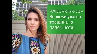 Kadorr group 8-я Жемчужина: дом с трещинами в палец на ноге