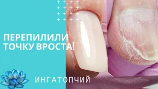 Точка вроста ногтя! Как восстановить. Ошибки в маникюре #10