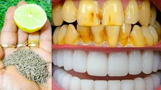 सिर्फ 2 मिनट में पीले दांतो को मोती की तरह चमका देगा यह अद्भुत घरेलू नुस्खा Teeth Whitening Remedy