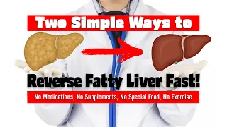 Two Simple Ways to Reverse Fatty Liver Fast!