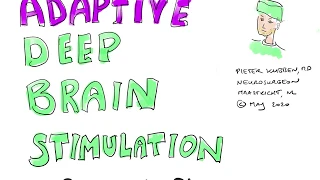 Adaptive Deep Brain Stimulation in Parkinson Disease