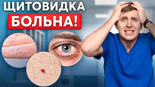 ЩИТОВИДКА БЬЕТ ТРЕВОГУ! Причины и признаки заболеваний щитовидки