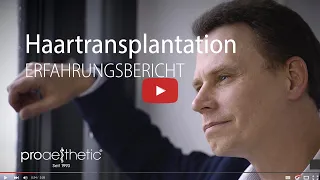 Haartransplantation | Ergebnis-Erfahrungsbericht | proaesthetic Heidelberg
