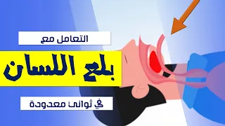 بلع اللسان عند لاعبين كرة القدم | كيف تنقذ حالات انسداد مجرى التنفس؟؟