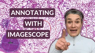 Aperio ImageScope | Free Annotation Tool for Pathology