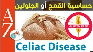 Celiac disease |From A to Z| حساسية القمح او الجلوتين | أعراض مرض السيلياك والعلاج للأطفال والكبار