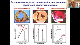 Патофизиология сердечной недостаточности