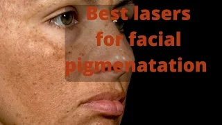 How to treat skin pigmentation