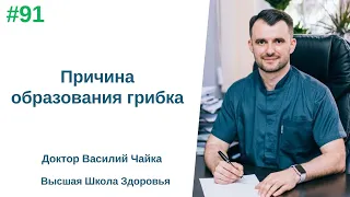 #91 Причина образования грибка. Спросите у доктора Василия Чайки, Высшая школа здоровья