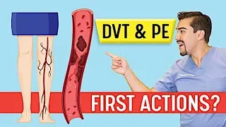 DVT Animation   Deep Vein Thrombosis and Pulmonary Embolism PE   Memory Tricks for Exams NCLEX & nur