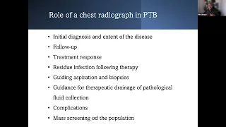 Radiographic appearances of Pulmonary Tuberculosis on a Chest Radiograph