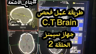كورس الأشعة المقطعية | فحص المقطعية علي المخ CT Brain | الحلقة 2