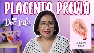 TUNGKOL SA PLACENTA PREVIA with Doc Leila, OB-GYN (Philippines)