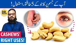 "KAJU" Khane Ka "SAHI" Tarika - Are Cashews Good For You? Urdu/Hindi - Dr. Ibrahim