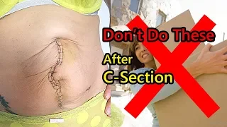 11 Things You Should Avoid After C-Section (Restrictions after C Section)