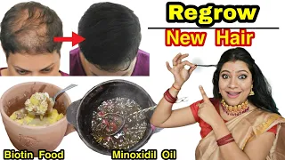 Cure Baldness And Hair Thinning: Regrow New Hair & Increase Thickness of Hair नये बाल उगायें ।