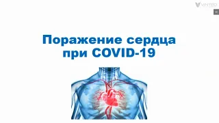 Лекция по COVID 19