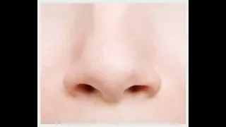 3a  Diseases of external nose || for MBBS, PG students