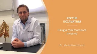 Pectus Excavatum -Técnica mínimamente invasiva - Dr. Maximiliano Nazar - Clínica Mi Pectus
